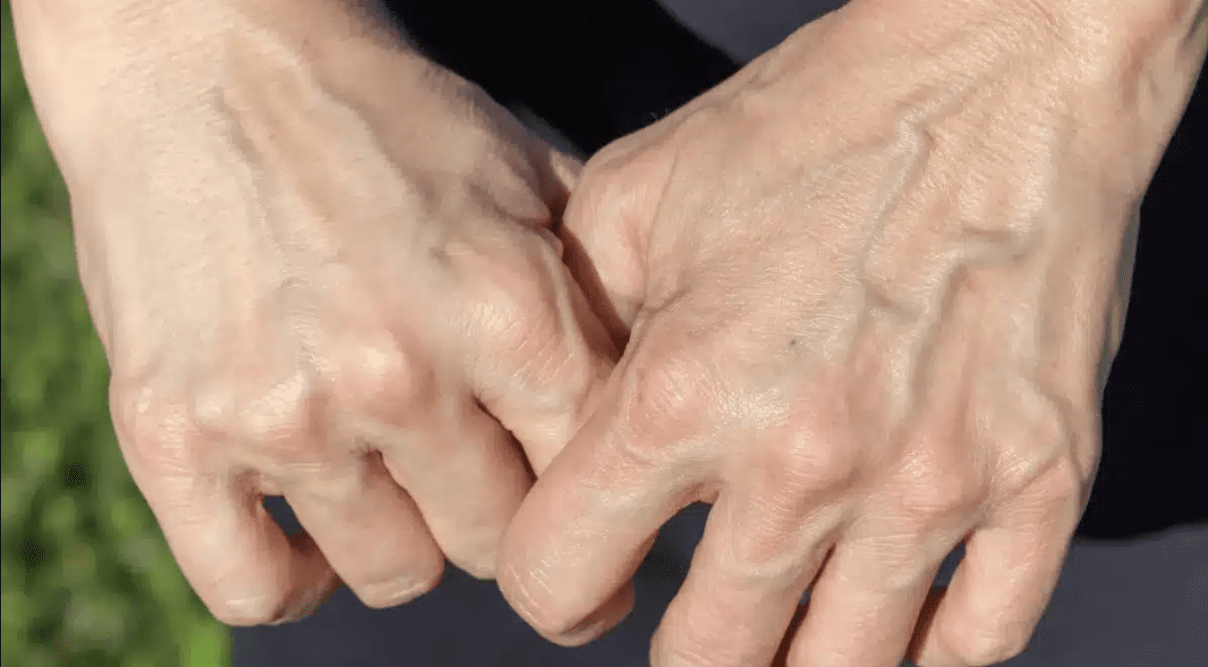 Visible Veins: What Do