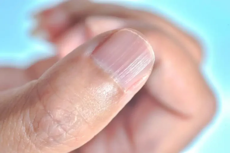 les-stries-sur-les-ongles.jpg