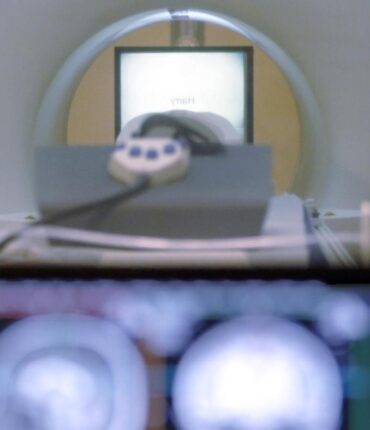 Man dies after metal chain pulls him into MRI machine, sparking safety investigation