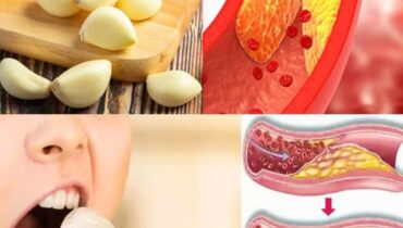 This simple trick with raw garlic that cardiologists don’t want you to know about