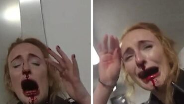 Police officer reveals terrifying moment her nose was shattered: “I felt this excruciating pain and…”