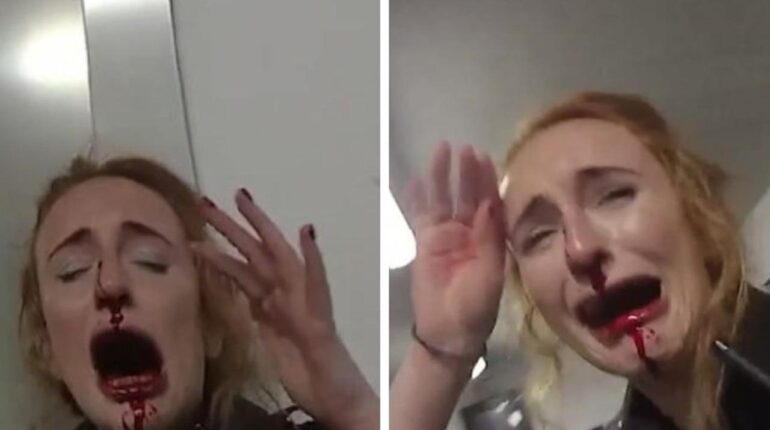 Police officer reveals terrifying moment her nose was shattered: “I felt this excruciating pain and…” Assault Crime Incidents Law Enforcement Officer Safety Police