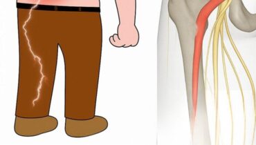 3 Stretches That Target Sciatic Nerve Pain – No Gym Needed