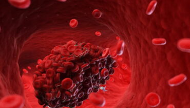 blood clot prevention cardiologist tips circulation compression socks deep vein thrombosis DVT risk Healthy Habits heart disease prevention prolonged sitting dangers pulmonary embolism sedentary lifestyle workplace health 