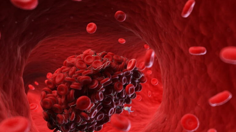 Cardiologists Warn: This Common Habit Increases Your Blood Clot Risk blood clot prevention cardiologist tips circulation compression socks deep vein thrombosis DVT risk Healthy Habits heart disease prevention prolonged sitting dangers pulmonary embolism sedentary lifestyle workplace health