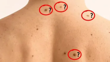 How to Spot Dangerous Skin Changes Before It’s Too Late How to Spot Dangerous Skin Changes Before It’s Too Late