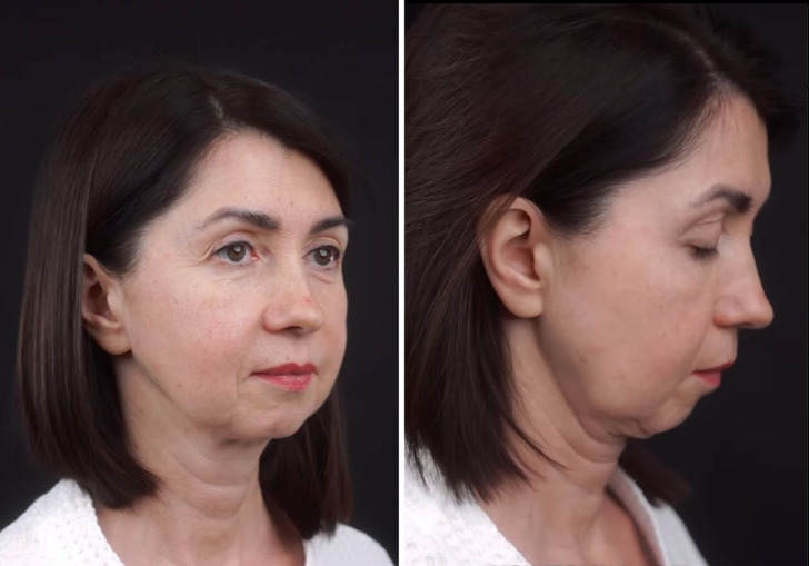 “She Looks 20 Years