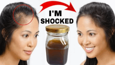 DIY Turmeric, Avocado Seed & Clove Hair Tonic Regrow Hair & Stop Thinning Naturally DIY Turmeric, Avocado Seed & Clove Hair Tonic Regrow Hair & Stop Thinning Naturally