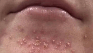 Be careful! These are the consequences of sleeping with the… Be careful! These are the consequences of sleeping with the…