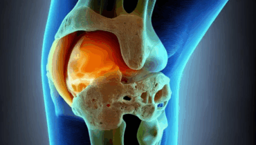 Germany’s Cartilage Repair Gel: Hope, Hype, and the Future of Joint Regeneration