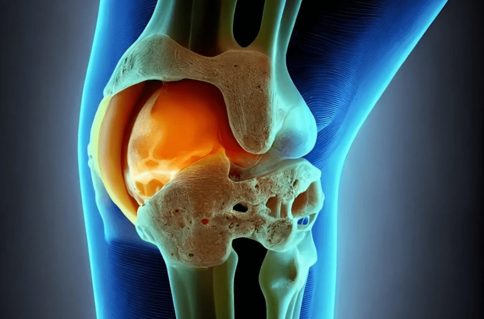 Germany S Cartilage Repair Gel Hope Hype And The Future Of Joint