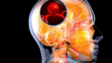 12 signs that may signal a brain aneurysm — Don’t ignore them