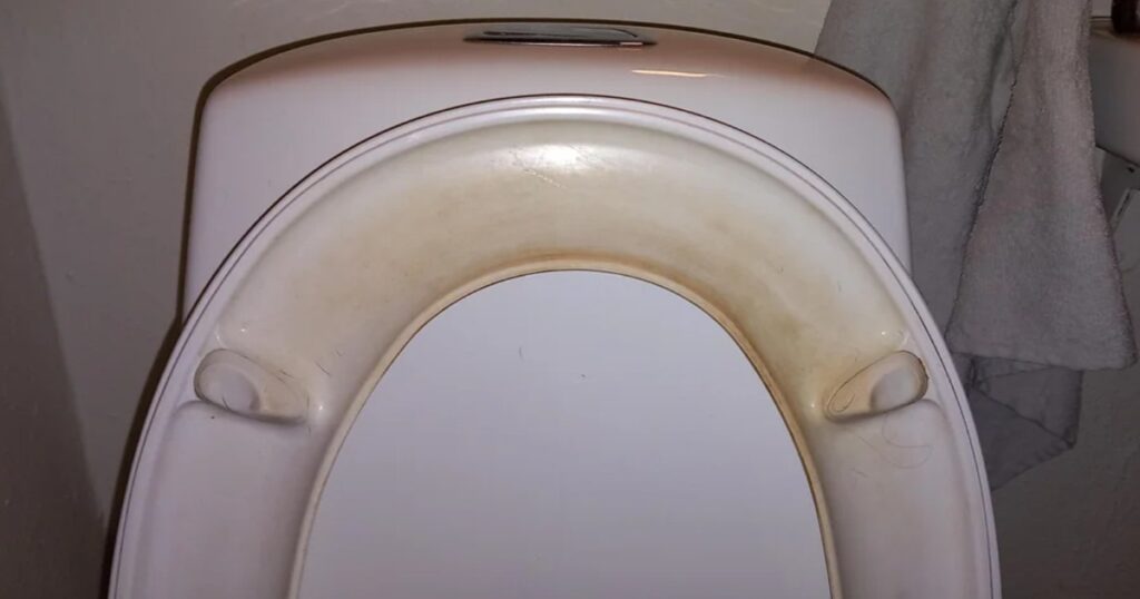 dirty-hair-toilet dirty-hair-toilet