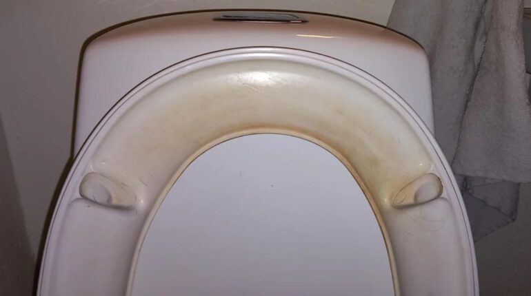 baking soda vinegar toilet cleaner clean toilet bowl stains deep clean toilet seat hydrogen peroxide toilet cleaning natural toilet cleaning methods remove hard water stains toilet remove yellow toilet seat stains 