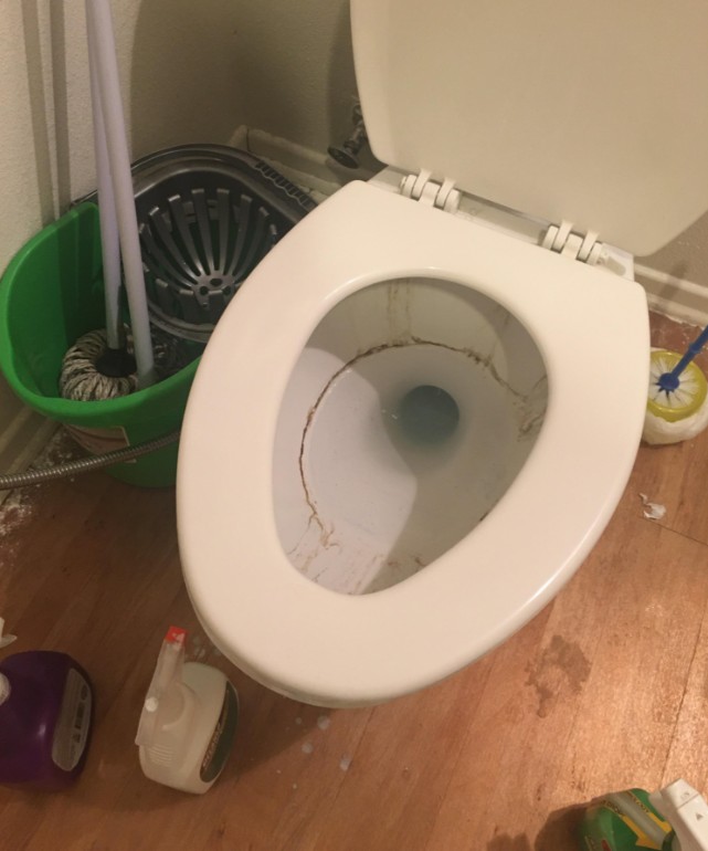 Cleaning yellow toilet seat stains