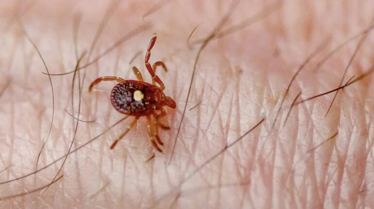 how to remove a tick lone star tick bite lone star tick dangers tick bite symptoms tick prevention tips tick removal guide what to do after tick bite 