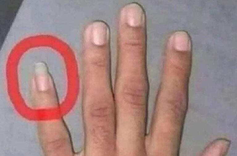 kepo