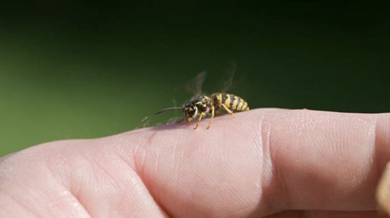 allergic reaction to wasp sting how to remove wasp stinger how to treat wasp stings natural wasp sting remedies painful wasp sting wasp prevention tips wasp sting home cure wasp sting treatment wasp vs bee sting what attracts wasps 