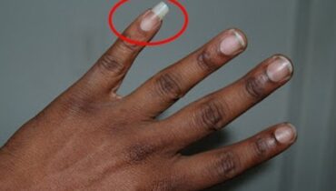 The Long Pinky Nail: Cultural History, Hidden Meanings & Modern Uses
