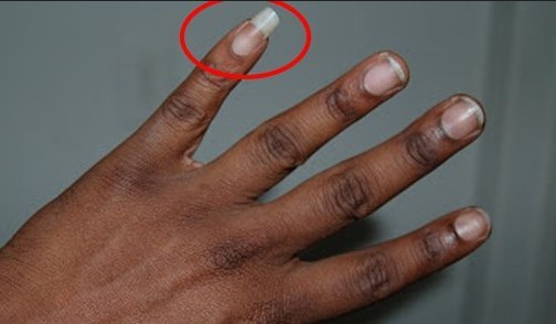 nail long4