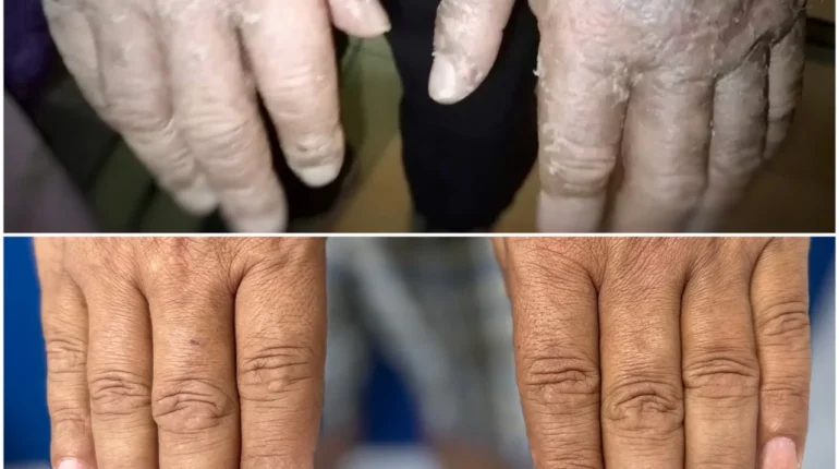 causes of mouth cancer mouth cancer mouth cancer prevention oral cancer stages oral cancer symptoms oral cancer treatment 