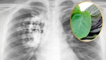 Paederia Foetida (Lá Mơ Lông): Traditional Remedies, Pneumonia Relief, and Healing Benefits