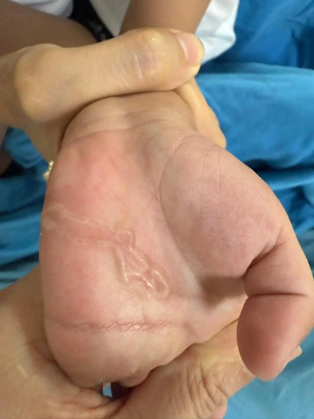 A Boy’s Hand Shows Strange Signs