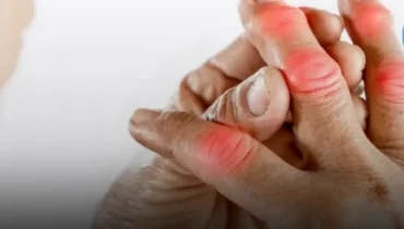 8 Early Warning Signs of Art.hr.itis You Must Pay Attention To