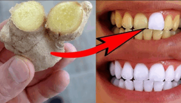 Whiten Your Teeth Naturally in Just 2 Minutes