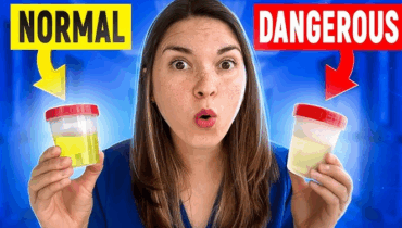 Men and women who see these 3 signs in their urine need to see a doctor Men and women who see these 3 signs in their urine need to see a doctor