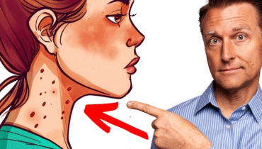 8 Signs That Indicate You Have Too Much Sugar 8 Signs That Indicate You Have Too Much Sugar