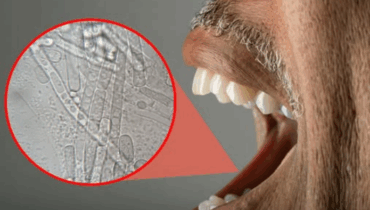 Could your mouth bacteria be plotting against your heart? Could your mouth bacteria be plotting against your heart?