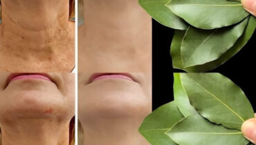 Is Bay Leaf 100,000 Times More Effective Than Botox? | A Natural Remedy for Wrinkles Even at Age 70!
