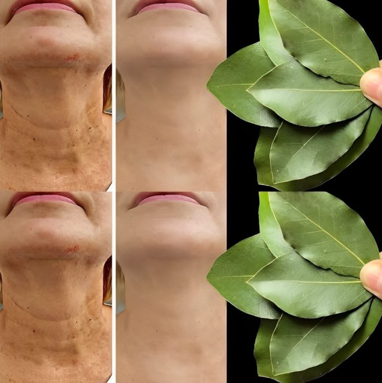 botox-skin-face