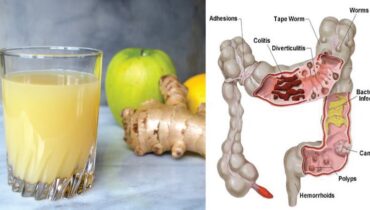 colon detox Fruits ginger health juice Juice: Apples Lemon 
