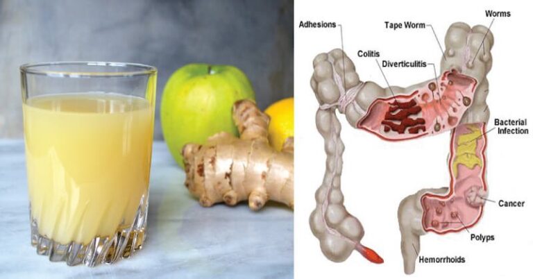 colon-ginger-fb