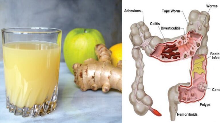 colon detox Fruits ginger health juice Juice: Apples Lemon 