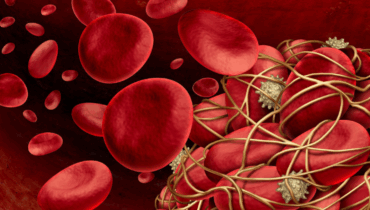 8 Nutrients That Naturally Dissolve Blood Clots – Doctors Don’t Share Tip #5…