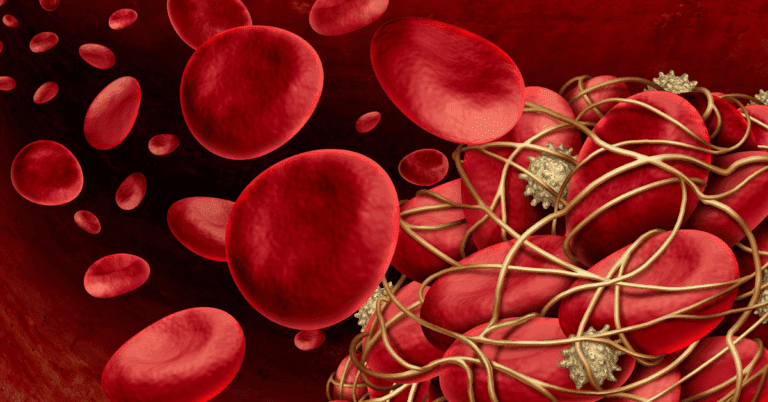 dissolve-blood-clots-1200-x-628-1