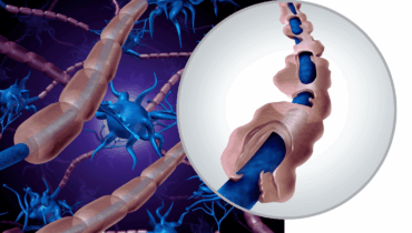 Shocking Cause of Nerve Pain Doctors Never Tell You About… Could the Cure Be in Your Fridge? Shocking Cause of Nerve Pain Doctors Never Tell You About… Could the Cure Be in Your Fridge?