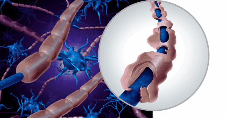 nerve-pain-1