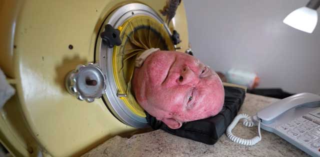 76-year-old man, paralyzed from