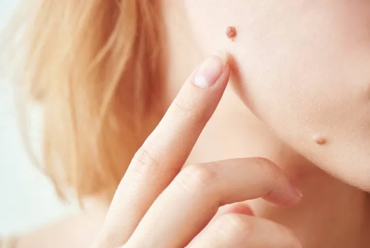 skin-care-3