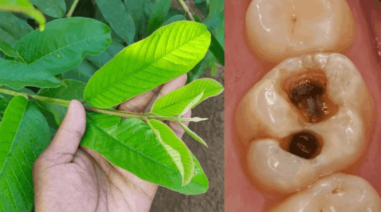 guava guava leaves antibacterial benefits guava leaves for bad breath guava leaves for gums guava leaves for teeth guava leaves gum inflammation guava leaves mouth rinse guava leaves oral health guava leaves tooth decay herbal remedy for toothache home remedies for plaque how to use guava leaves for teeth natural dental care natural oral hygiene natural remedy for cavities 