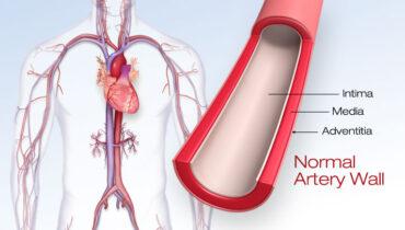 A vitamin prevents calcium buildup in the arteries and heart A vitamin prevents calcium buildup in the arteries and heart