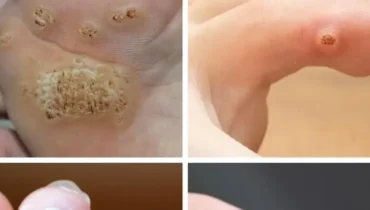Here’s what doctors never told you about those bumps on your skin