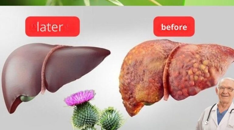 antioxidants beetroot digestion issues Detoxification foods bad for liver health Herbal Medicine natural remedies Plant Benefits 