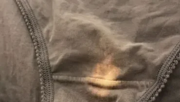 At 47, doctors finally explain what these marks on your underwear really mean At 47, doctors finally explain what these marks on your underwear really mean