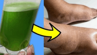 The Natural Remedy Doctors Are Whispering About: “I Drink This Twice Daily and…” The Natural Remedy Doctors Are Whispering About: “I Drink This Twice Daily and…”