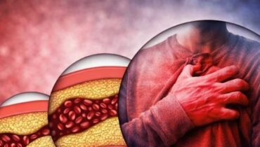 blood circulation bone and joint health prevention Detoxification Herbal Remedies Metabolism Natural Wellness 